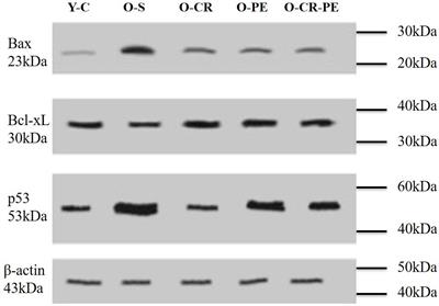 The Effects of Calorie Restriction and Exercise on Age-Related Alterations in Corpus Cavernosum